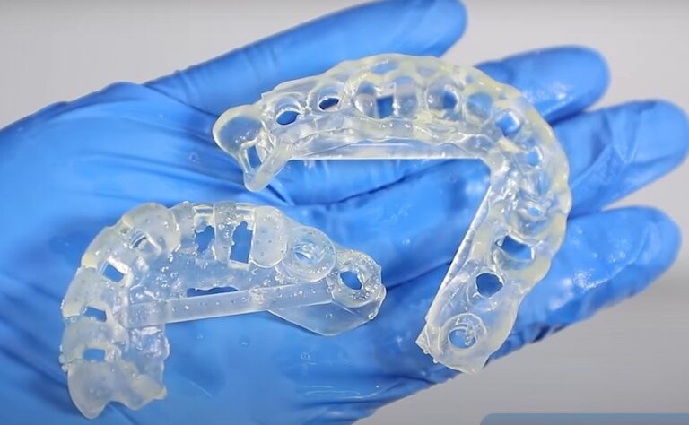 Dentist using a 3D printed surgical guide during dental implant procedure